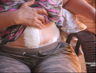 Campo Grande: Mulher esfaqueada pelo ex no Canguru nega estupro e diz não guardar mágoas 